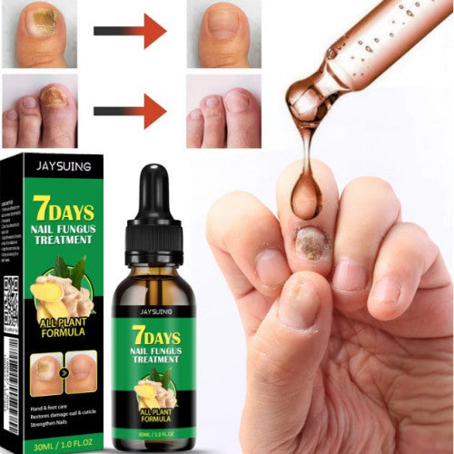 Uñas Perfectas 7 Días – Tratamiento Especializado