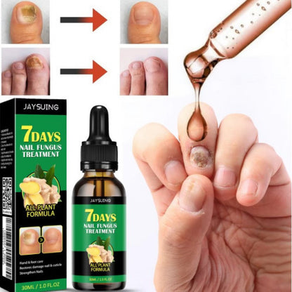 Uñas Perfectas 7 Días – Tratamiento Especializado