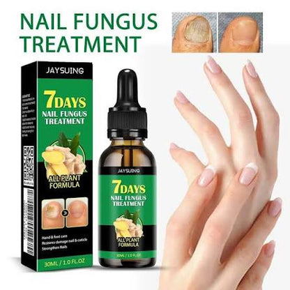 Uñas Perfectas 7 Días – Tratamiento Especializado
