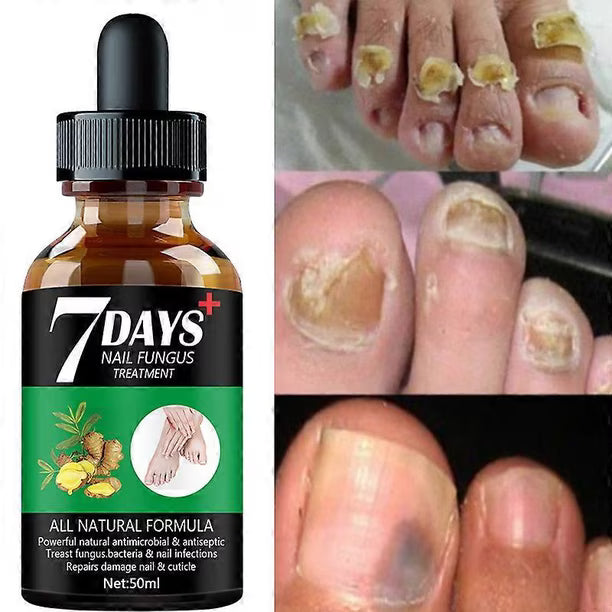 Uñas Perfectas 7 Días – Tratamiento Especializado