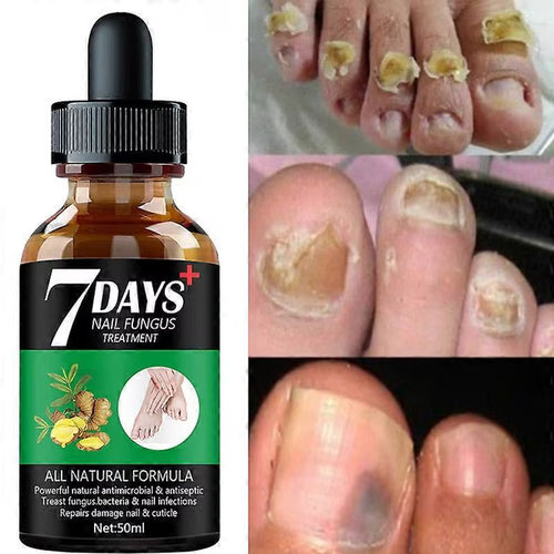 Uñas Perfectas 7 Días – Tratamiento Especializado